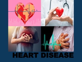HEART DISEASE
 