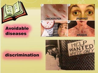Avoidable
diseases
discrimination
 