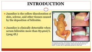 INTRODUCTION
⚫ Jaundice is the yellow discoloration of
skin, sclerae, and other tissues caused
by the deposition of bilirubin.
⚫ Jaundice is clinically detectable when
serum bilirubin more than 85ʮmol/L
(5mg/dL)
 