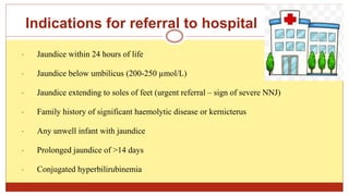 Indications for referral to hospital
• Jaundice within 24 hours of life
• Jaundice below umbilicus (200-250 µmol/L)
• Jaundice extending to soles of feet (urgent referral – sign of severe NNJ)
• Family history of significant haemolytic disease or kernicterus
• Any unwell infant with jaundice
• Prolonged jaundice of >14 days
• Conjugated hyperbilirubinemia
 