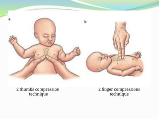 Basic Life Support Pediatrics........ | PPTX