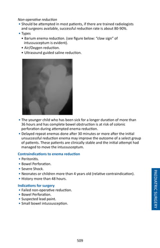 509
PAEDIATRICSURGERY
Non-operative reduction
• Should be attempted in most patients, if there are trained radiologists
and surgeons available, successful reduction rate is about 80-90%.
• Types
• Barium enema reduction. (see figure below: “claw sign” of
intussusceptum is evident).
• Air/Oxygen reduction.
• Ultrasound guided saline reduction.
• The younger child who has been sick for a longer duration of more than
36 hours and has complete bowel obstruction is at risk of colonic
perforation during attempted enema reduction.
• Delayed repeat enemas done after 30 minutes or more after the initial
unsuccessful reduction enema may improve the outcome of a select group
of patients. These patients are clinically stable and the initial attempt had
managed to move the intussusceptum.
Contraindications to enema reduction
• Peritonitis.
• Bowel Perforation.
• Severe Shock.
• Neonates or children more than 4 years old (relative contraindication).
• History more than 48 hours.
Indications for surgery
• Failed non-operative reduction.
• Bowel Perforation.
• Suspected lead point.
• Small bowel intussusception.
 
