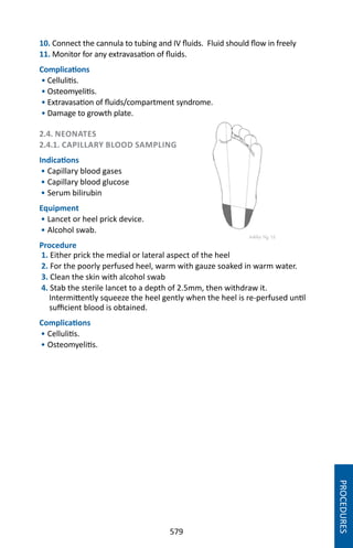 579
10. Connect the cannula to tubing and IV fluids. Fluid should flow in freely
11. Monitor for any extravasation of fluids.
Complications
• Cellulitis.
• Osteomyelitis.
• Extravasation of fluids/compartment syndrome.
• Damage to growth plate.
2.4. NEONATES
2.4.1. CAPILLARY BLOOD SAMPLING
Indications
• Capillary blood gases
• Capillary blood glucose
• Serum bilirubin
Equipment
• Lancet or heel prick device.
• Alcohol swab.
Procedure
1. Either prick the medial or lateral aspect of the heel
2. For the poorly perfused heel, warm with gauze soaked in warm water.
3. Clean the skin with alcohol swab
4. Stab the sterile lancet to a depth of 2.5mm, then withdraw it.
Intermittently squeeze the heel gently when the heel is re-perfused until
sufficient blood is obtained.
Complications
• Cellulitis.
• Osteomyelitis.
PROCEDURES
 