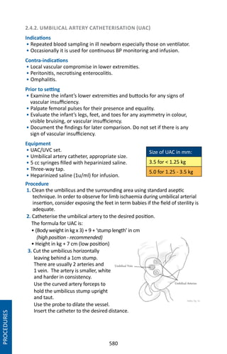 580
2.4.2. UMBILICAL ARTERY CATHETERISATION (UAC)
Indications
• Repeated blood sampling in ill newborn especially those on ventilator.
• Occasionally it is used for continuous BP monitoring and infusion.
Contra-indications
• Local vascular compromise in lower extremities.
• Peritonitis, necrotising enterocolitis.
• Omphalitis.
Prior to setting
• Examine the infant’s lower extremities and buttocks for any signs of
vascular insufficiency.
• Palpate femoral pulses for their presence and equality.
• Evaluate the infant’s legs, feet, and toes for any asymmetry in colour,
visible bruising, or vascular insufficiency.
• Document the findings for later comparison. Do not set if there is any
sign of vascular insufficiency.
Equipment
• UAC/UVC set.
• Umbilical artery catheter, appropriate size.
• 5 cc syringes filled with heparinized saline.
• Three-way tap.
• Heparinized saline (1u/ml) for infusion.
Procedure
1. Clean the umbilicus and the surrounding area using standard aseptic
technique. In order to observe for limb ischaemia during umbilical arterial
insertion, consider exposing the feet in term babies if the field of sterility is
adequate.
2. Catheterise the umbilical artery to the desired position.
The formula for UAC is:
• (Body weight in kg x 3) + 9 + ‘stump length’ in cm
(high position - recommended)
• Height in kg + 7 cm (low position)
3. Cut the umbilicus horizontally
leaving behind a 1cm stump.
There are usually 2 arteries and
1 vein. The artery is smaller, white
and harder in consistency.
Use the curved artery forceps to
hold the umbilicus stump upright
and taut.
Use the probe to dilate the vessel.
Insert the catheter to the desired distance.
Size of UAC in mm:
3.5 for  1.25 kg
5.0 for 1.25 - 3.5 kg
PROCEDURES
 