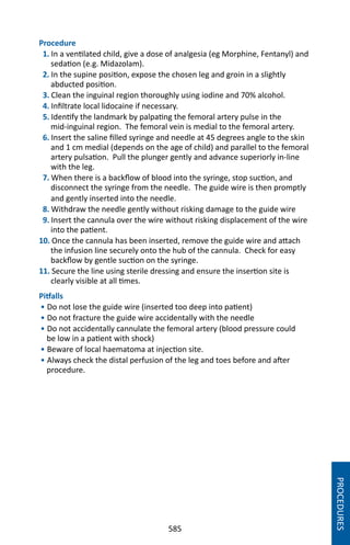 585
Procedure
1. In a ventilated child, give a dose of analgesia (eg Morphine, Fentanyl) and
sedation (e.g. Midazolam).
2. In the supine position, expose the chosen leg and groin in a slightly
abducted position.
3. Clean the inguinal region thoroughly using iodine and 70% alcohol.
4. Infiltrate local lidocaine if necessary.
5. Identify the landmark by palpating the femoral artery pulse in the
mid-inguinal region. The femoral vein is medial to the femoral artery.
6. Insert the saline filled syringe and needle at 45 degrees angle to the skin
and 1 cm medial (depends on the age of child) and parallel to the femoral
artery pulsation. Pull the plunger gently and advance superiorly in-line
with the leg.
7. When there is a backflow of blood into the syringe, stop suction, and
disconnect the syringe from the needle. The guide wire is then promptly
and gently inserted into the needle.
8. Withdraw the needle gently without risking damage to the guide wire
9. Insert the cannula over the wire without risking displacement of the wire
into the patient.
10. Once the cannula has been inserted, remove the guide wire and attach
the infusion line securely onto the hub of the cannula. Check for easy
backflow by gentle suction on the syringe.
11. Secure the line using sterile dressing and ensure the insertion site is
clearly visible at all times.
Pitfalls
• Do not lose the guide wire (inserted too deep into patient)
• Do not fracture the guide wire accidentally with the needle
• Do not accidentally cannulate the femoral artery (blood pressure could
be low in a patient with shock)
• Beware of local haematoma at injection site.
• Always check the distal perfusion of the leg and toes before and after
procedure.
PROCEDURES
 