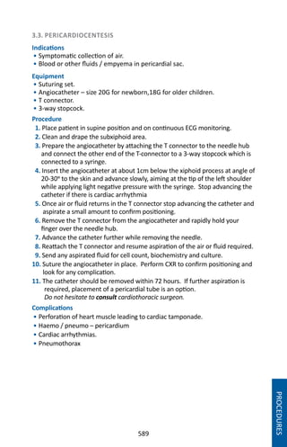 589
3.3. PERICARDIOCENTESIS
Indications
• Symptomatic collection of air.
• Blood or other fluids / empyema in pericardial sac.
Equipment
• Suturing set.
• Angiocatheter – size 20G for newborn,18G for older children.
• T connector.
• 3-way stopcock.
Procedure
1. Place patient in supine position and on continuous ECG monitoring.
2. Clean and drape the subxiphoid area.
3. Prepare the angiocatheter by attaching the T connector to the needle hub
and connect the other end of the T-connector to a 3-way stopcock which is
connected to a syringe.
4. Insert the angiocatheter at about 1cm below the xiphoid process at angle of
20-30o to the skin and advance slowly, aiming at the tip of the left shoulder
while applying light negative pressure with the syringe. Stop advancing the
catheter if there is cardiac arrhythmia
5. Once air or fluid returns in the T connector stop advancing the catheter and
aspirate a small amount to confirm positioning.
6. Remove the T connector from the angiocatheter and rapidly hold your
finger over the needle hub.
7. Advance the catheter further while removing the needle.
8. Reattach the T connector and resume aspiration of the air or fluid required.
9. Send any aspirated fluid for cell count, biochemistry and culture.
10. Suture the angiocatheter in place. Perform CXR to confirm positioning and
look for any complication.
11. The catheter should be removed within 72 hours. If further aspiration is
required, placement of a pericardial tube is an option.
Do not hesitate to consult cardiothoracic surgeon.
Complications
• Perforation of heart muscle leading to cardiac tamponade.
• Haemo / pneumo – pericardium
• Cardiac arrhythmias.
• Pneumothorax
PROCEDURES
 