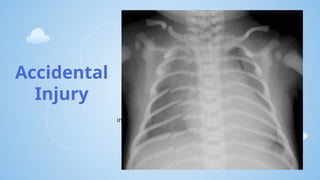 Non Incapacitating Injury Paediatric trauma and NAI(Non accidental injuries).pptx