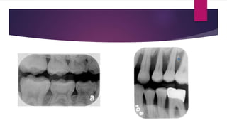 RADIOLOGY IN PEDIATRIC DENTISTRY | PPTX
