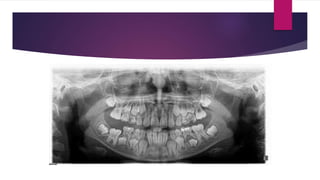 RADIOLOGY IN PEDIATRIC DENTISTRY | PPTX