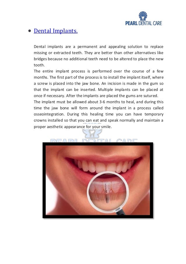 Pearl Dental Care Specialites