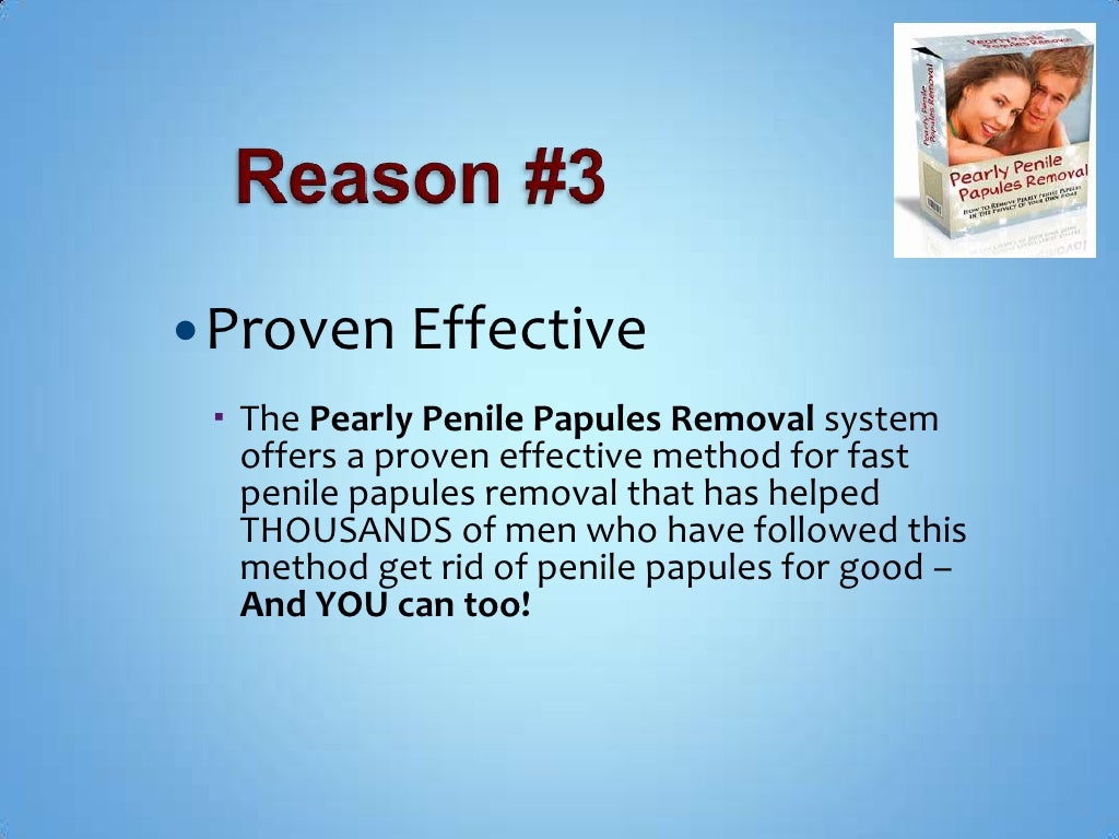 pearly papules removal easy and quickly at home pearly papules removal easy and quickly at home