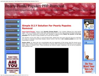 pearly penile papules ppp removal - Pearly-Papules-Removal-The-Fast-Home-Alternative-Cure-14/

Pearly Penile Papules PPP Removal
Can A D.I.Y Home Removal Remedy Actually Work For Hirsuties Papillaris Genitalis? Read The Exclusive Review Here!

 29

November, 2013
 

Pearly Penile Papules Removal

Penis Problems

Mens Sexual Health News

About Us

Privacy Policy

Contact Us

Simple D.I.Y Solution For Pearly Papules
Removal
Pearly Penile Papules, medical name Hirsuties Coronae Glandis, is an irritation affecting the male genital
organ. This is a condition where small flesh colored bumps form on the ridge around the head of the penis.
This is a harmless anatomical occurrence that manifests in approximately twenty five percent of the male
population from as early an age as twelve up to and into the forties.
This situation occurs more often in uncircumcised males. While some men worry that this may be a mild form
of a virus or a sexually transmitted disease; doctors confirm that this is not a medical problem nor can it be
transmitted to anyone.
Doctors advise, for those who are uncomfortable with the appearance of the bumps, that the clinical cure is
either laser or electro surgery using a hyfrecator for removal. Both procedures are performed in an out patient
status, often in a doctor’s clinic. These procedures are elective surgery, expensive, and, as with all surgeries,
have potential risks.

Our Site Map

Bookmark This Website

 
http://www.pearlypenilepapulespppremoval.com/[29/11/2013 16:57:11]

 