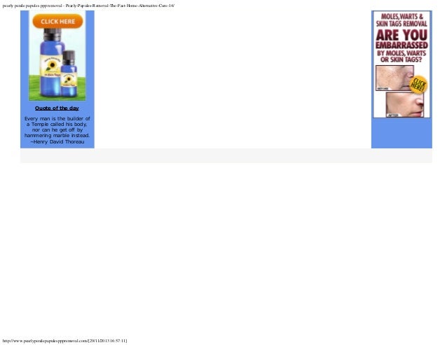 pearly papules removal the fast home alternative cure pearly papules removal the fast home alternative cure