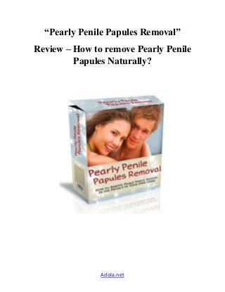 “Pearly Penile Papules Removal” 
Review – How to remove Pearly Penile 
Papules Naturally? 
Adola.net 
 