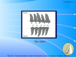 113
Roth tip
Roth tip
0º 0º 7º 0º 0º
0º 0º 9º 9º 5º
Tip values
Roth, R.H.: Treatment Mechanics for SWA in Orthodontics: Current principles and techniques. JCO 1985
ROTH Prescription…
 
