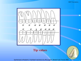 116
5º 5º 0º 0º 8º 8º 4º
2º 2º 2
º
2º 3º 0º 0º
Tip values
Systemized orthodontic treatment mechanics by McLaughlin, Bennett and Trevisi 2001
MBT Prescription…
 