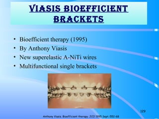 ViASiS bioefficieNT
bRAckeTS
• Bioefficient therapy (1995)
• By Anthony Viasis
• New superelastic A-NiTi wires
• Multifunctional single brackets
129
Anthony Viasis. Bioefficient therapy. JCO 1995 Sept.:552-68
 