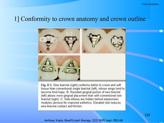 1] Conformity to crown anatomy and crown outline
130
Anthony Viasis. Bioefficient therapy. JCO 1995 Sept.:552-68
Viasis brackets…
 