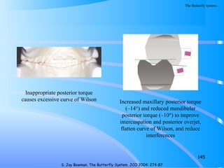 145
S. Jay Bowman. The Butterfly System. JCO 2004: 274-87
Inappropriate posterior torque
causes excessive curve of Wilson Increased maxillary posterior torque
(–14°) and reduced mandibular
posterior torque (–10°) to improve
intercuspation and posterior overjet,
flatten curve of Wilson, and reduce
interferences
The Butterfly system…
 