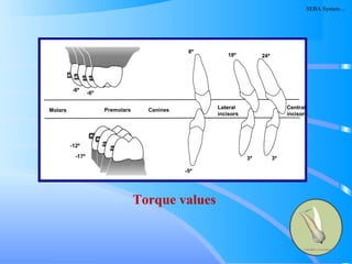 158
Molars Premolars Canines Lateral
incisors
Central
incisors
-5º
3º3º
-12º
-17º
-6º
-6º
8º
18º 24º
Torque values
SEBA System…
 