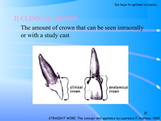 2] CLINICAL CROWN
The amount of crown that can be seen intraorally
or with a study cast
21
STRAIGHT WIRE: The concept and appliance by Lawrence F Andrews. 1989
Six keys to optimal occlusion…
 