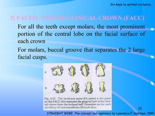 3] FACIAL AXIS OF CLINICAL CROWN (FACC)
For all the teeth except molars, the most prominent
portion of the central lobe on the facial surface of
each crown
For molars, buccal groove that separates the 2 large
facial cusps.
22
STRAIGHT WIRE: The concept and appliance by Lawrence F Andrews. 1989
Six keys to optimal occlusion…
 