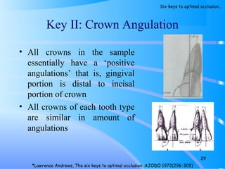 Key II: Crown Angulation
• All crowns in the sample
essentially have a ‘positive
angulations’ that is, gingival
portion is distal to incisal
portion of crown
• All crowns of each tooth type
are similar in amount of
angulations
29
*Lawrence Andrews, The six keys to optimal occlusion. AJODO 1972(296-309)
Six keys to optimal occlusion…
 