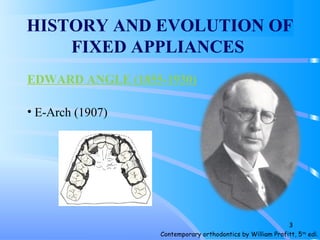 HISTORY AND EVOLUTION OF
FIXED APPLIANCES
EDWARD ANGLE (1855-1930)
• E-Arch (1907)
Contemporary orthodontics by William Profitt, 5th
edi.
3
 