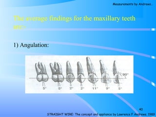 The average findings for the maxillary teeth
are:-
1) Angulation:
STRAIGHT WIRE: The concept and appliance by Lawrence F Andrews. 1989
40
Measurements by Andrews…
 