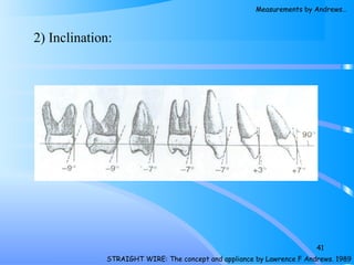 2) Inclination:
41
STRAIGHT WIRE: The concept and appliance by Lawrence F Andrews. 1989
Measurements by Andrews…
 