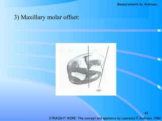 3) Maxillary molar offset:
42
STRAIGHT WIRE: The concept and appliance by Lawrence F Andrews. 1989
Measurements by Andrews…
 