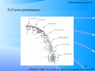 3) Crown prominence:
46
STRAIGHT WIRE: The concept and appliance by Lawrence F Andrews. 1989
Measurements by Andrews…
 