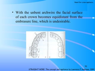 • With the unbent archwire the facial surface
of each crown becomes equidistant from the
embrasure line, which is undesirable.
70
STRAIGHT WIRE: The concept and appliance by Lawrence F Andrews. 1989
Need for a new appliance…
 