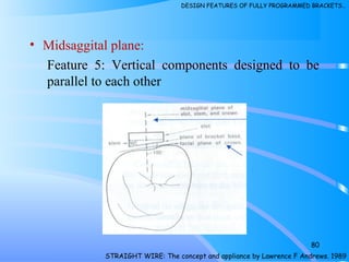 • Midsaggital plane:
Feature 5: Vertical components designed to be
parallel to each other
80
STRAIGHT WIRE: The concept and appliance by Lawrence F Andrews. 1989
DESIGN FEATURES OF FULLY PROGRAMMED BRACKETS…
 