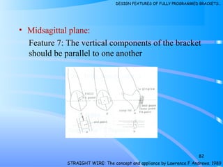 • Midsagittal plane:
Feature 7: The vertical components of the bracket
should be parallel to one another
82
STRAIGHT WIRE: The concept and appliance by Lawrence F Andrews. 1989
DESIGN FEATURES OF FULLY PROGRAMMED BRACKETS…
 