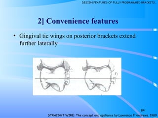 • Gingival tie wings on posterior brackets extend
further laterally
84
2] Convenience features
STRAIGHT WIRE: The concept and appliance by Lawrence F Andrews. 1989
DESIGN FEATURES OF FULLY PROGRAMMED BRACKETS…
 