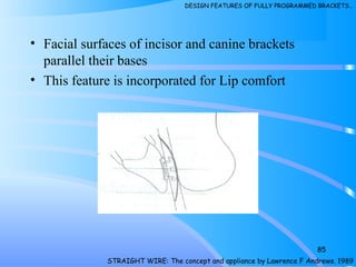 • Facial surfaces of incisor and canine brackets
parallel their bases
• This feature is incorporated for Lip comfort
85
STRAIGHT WIRE: The concept and appliance by Lawrence F Andrews. 1989
DESIGN FEATURES OF FULLY PROGRAMMED BRACKETS…
 