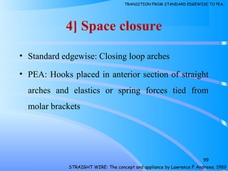 4] Space closure
• Standard edgewise: Closing loop arches
• PEA: Hooks placed in anterior section of straight
arches and elastics or spring forces tied from
molar brackets
99
STRAIGHT WIRE: The concept and appliance by Lawrence F Andrews. 1989
TRANSITION FROM STANDARD EDGEWISE TO PEA…
 