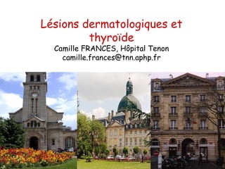 Lésions dermatologiques et thyroïde Camille FRANCES, Hôpital Tenon [email_address] 