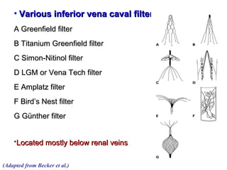 • Various inferior vena caval filtersVarious inferior vena caval filters::
A Greenfield filterA Greenfield filter
B Titanium Greenfield filterB Titanium Greenfield filter
C Simon-Nitinol filterC Simon-Nitinol filter
D LGM or Vena Tech filterD LGM or Vena Tech filter
E Amplatz filterE Amplatz filter
F Bird’s Nest filterF Bird’s Nest filter
G Günther filterG Günther filter
**Located mostly below renal veinsLocated mostly below renal veins
(Adapted from Becker et al.)
 