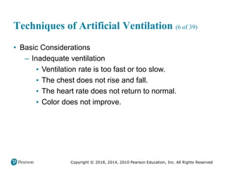 Pec11 chap 10   airway, ventilation, oxygenation