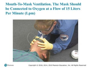 Pec11 chap 10   airway, ventilation, oxygenation