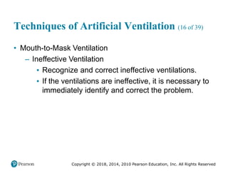 Pec11 chap 10   airway, ventilation, oxygenation
