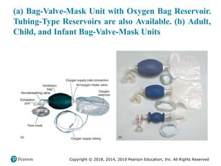 Pec11 chap 10   airway, ventilation, oxygenation