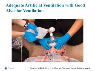 Pec11 chap 10   airway, ventilation, oxygenation