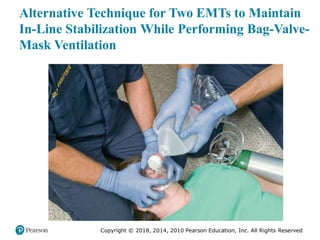 Pec11 chap 10   airway, ventilation, oxygenation
