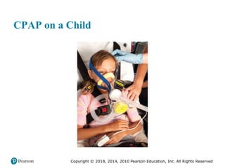 Pec11 chap 10   airway, ventilation, oxygenation