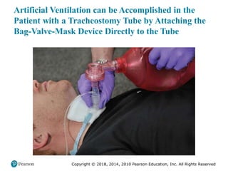 Pec11 chap 10   airway, ventilation, oxygenation
