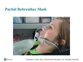 Pec11 chap 10   airway, ventilation, oxygenation