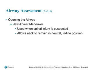 Pec11 chap 10   airway, ventilation, oxygenation
